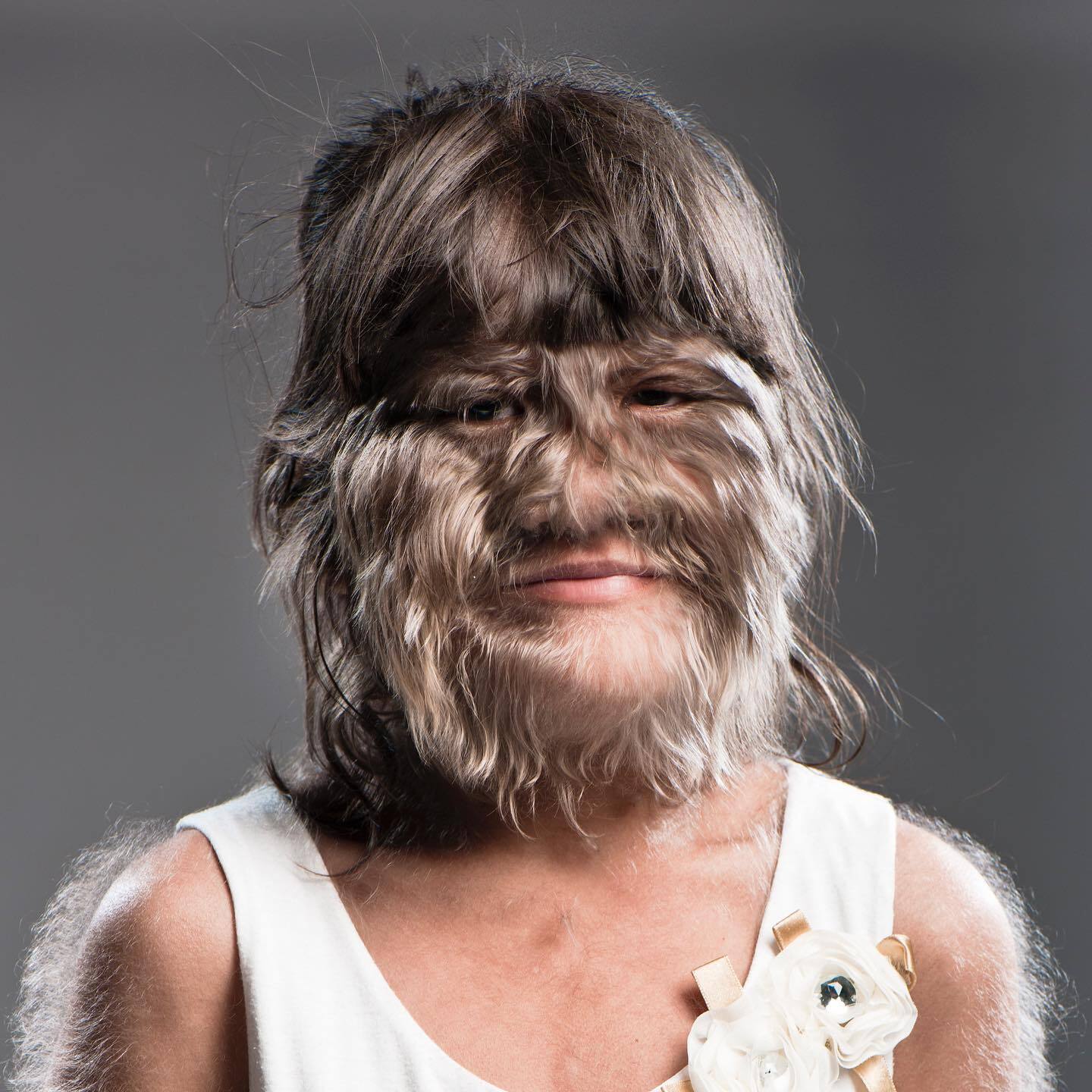 Який вигляд сьогодні має найволохатіша жінка світу з Книги рекордів Гіннеса: вийшла заміж і почала голитися