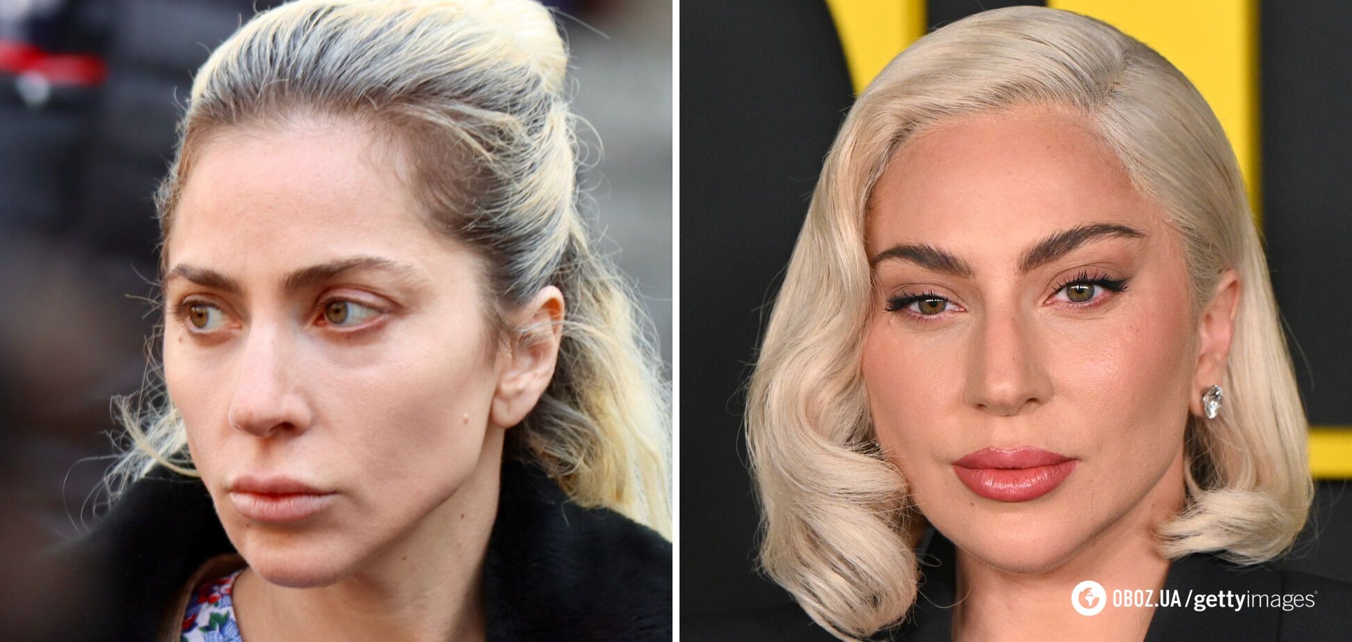 37-річна Леді Гага розчарувала шанувальників через "ботокс і філери" в обличчі. Фото до і після
