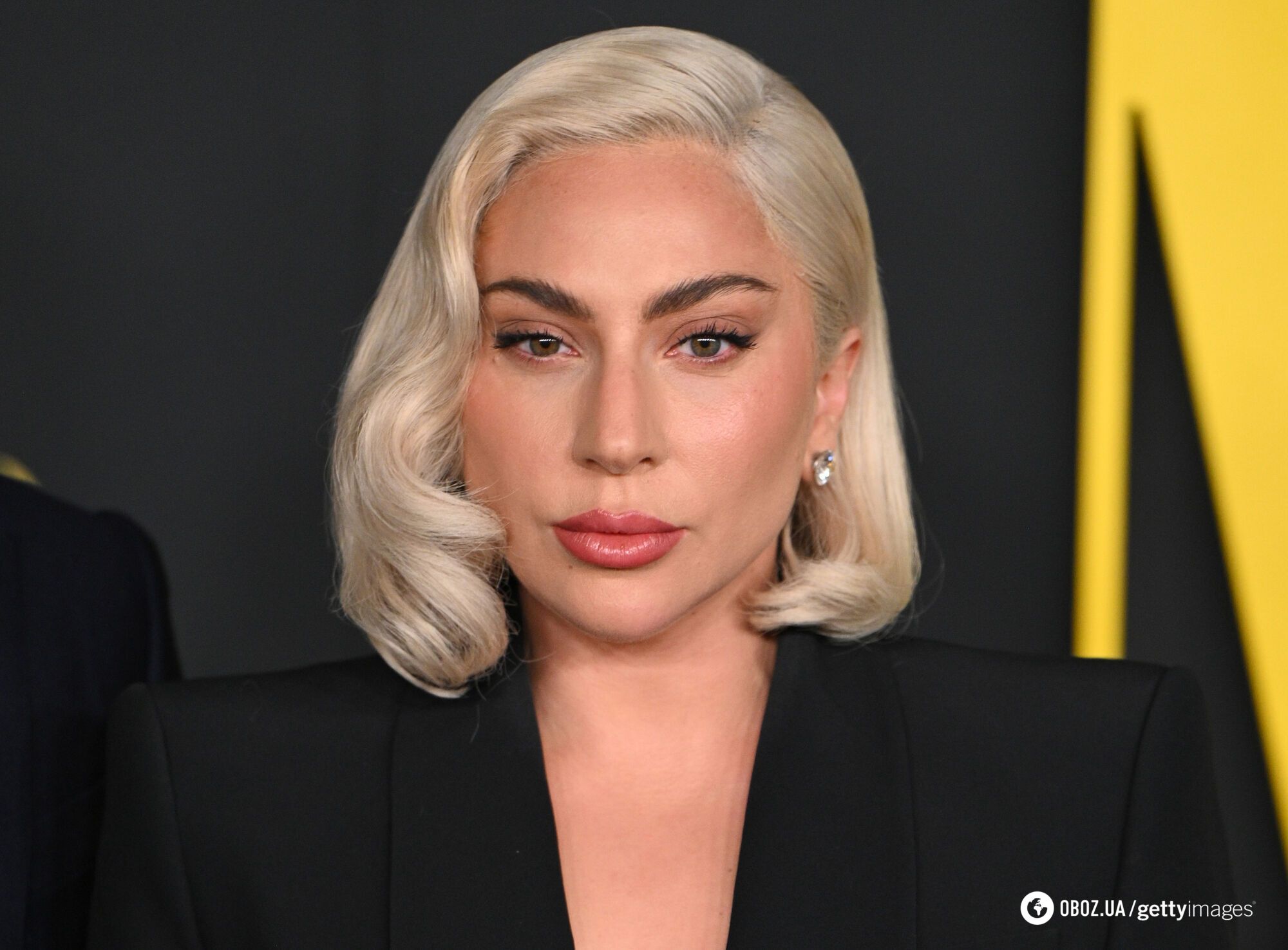 37-річна Леді Гага розчарувала шанувальників через "ботокс і філери" в обличчі. Фото до і після