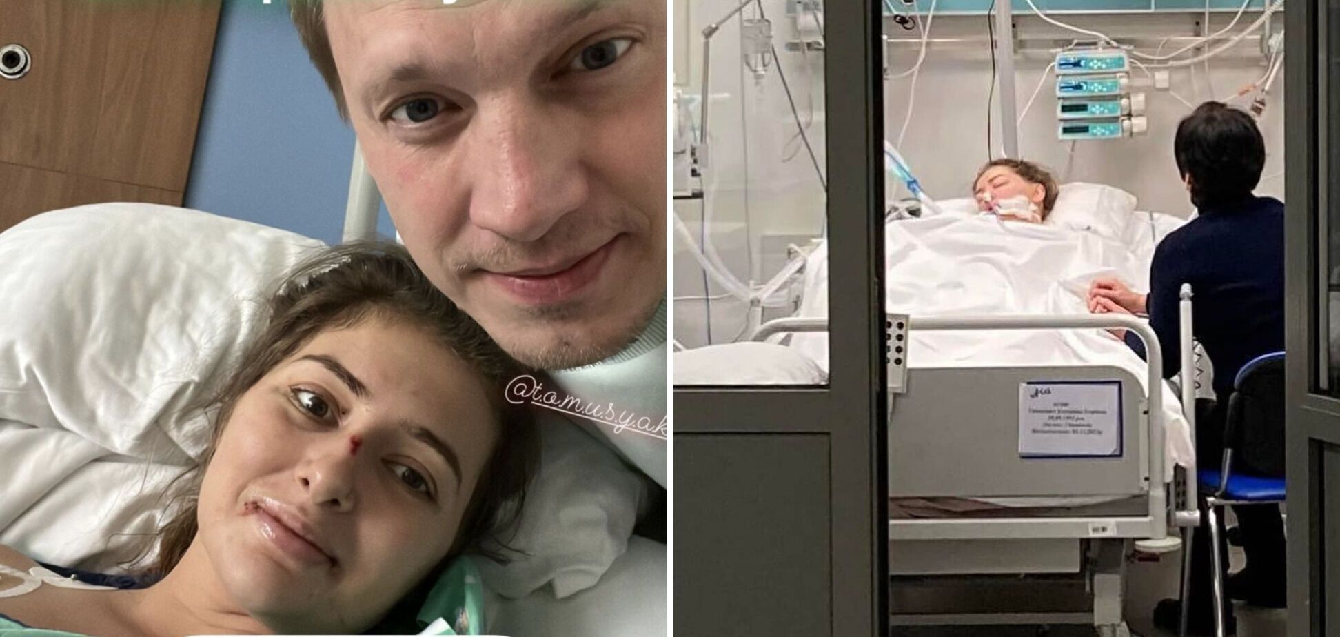 Тяжелобольная Екатерина Тышкевич, которую выписали из больницы, впервые за неделю вышла на связь