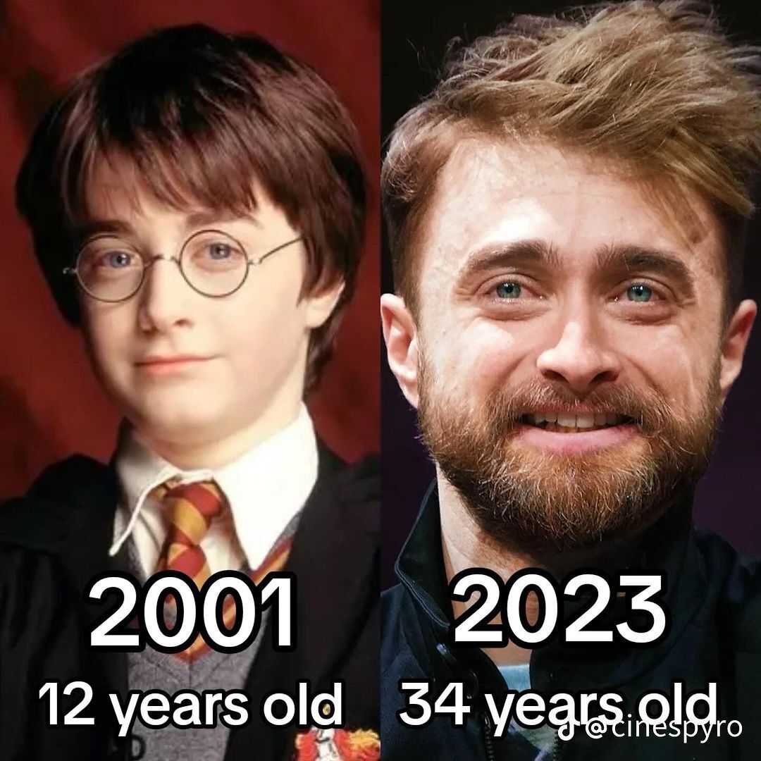 Как изменились звезды "Гарри Поттера" за 20 лет и почему фанаты смеются над Добби