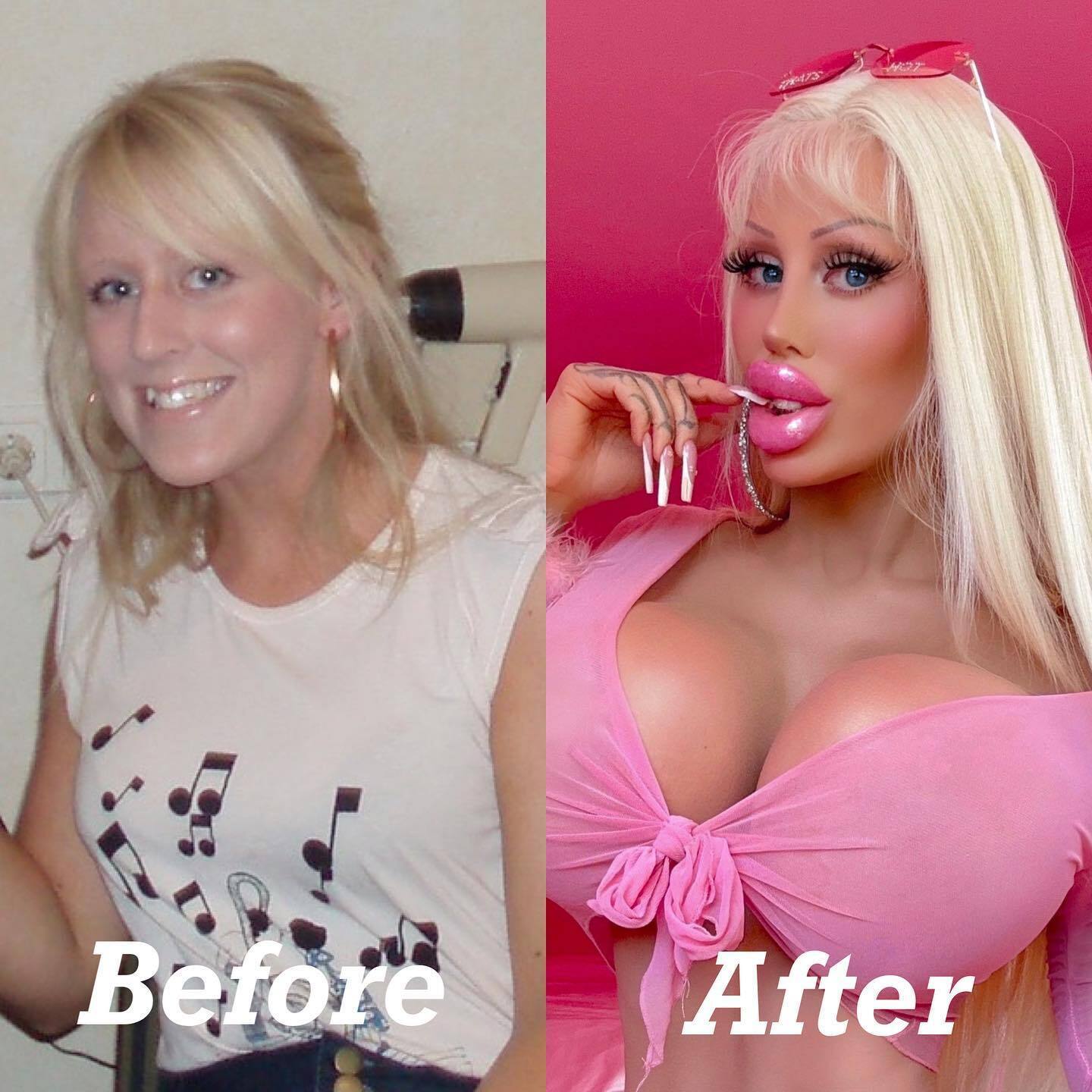 Модель OnlyFans, яка витратила 200 тисяч доларів, щоб стати лялькою "Барбі", видалила всі татуювання. Фото до і після