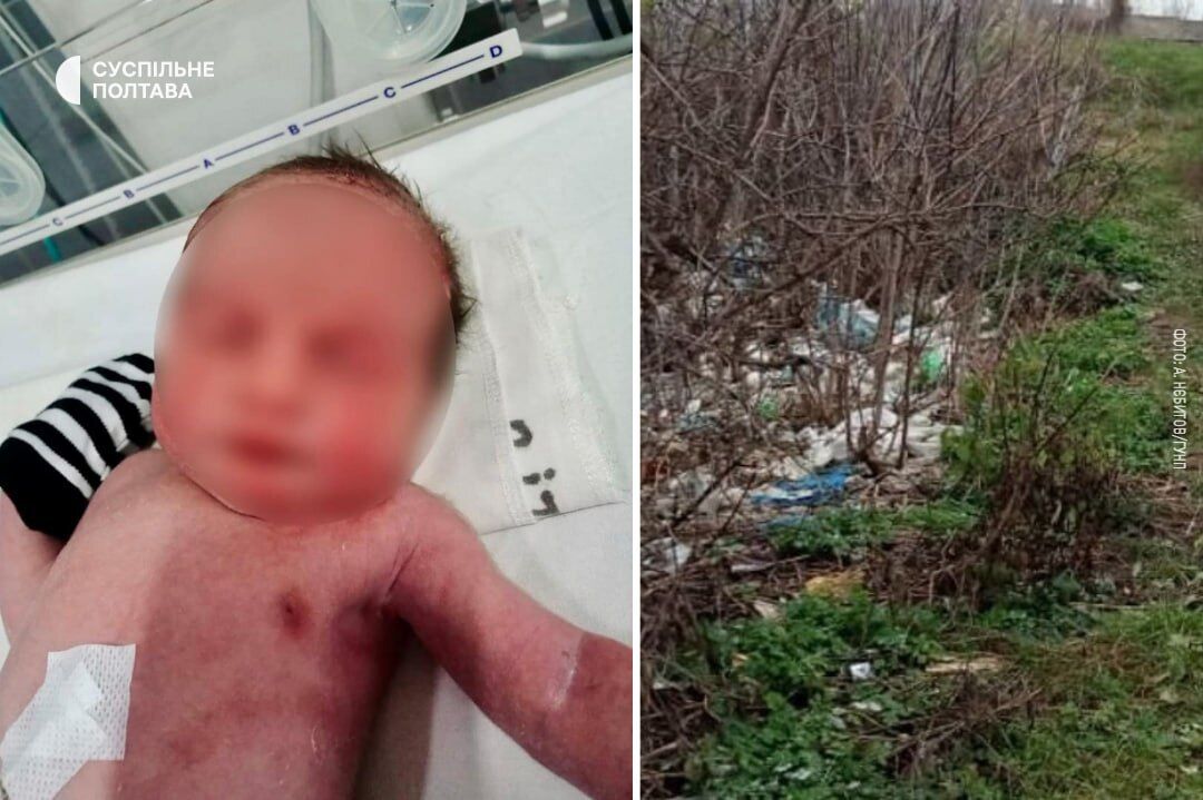 З'явилися дані про стан немовляти, яке знайшли на смітнику на Полтавщині: його викинула мати