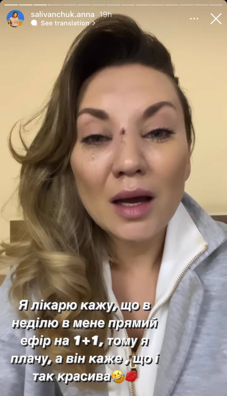 "Послизнулась і перелом": Саліванчук змусила фанів понервувати, показавши понівечене обличчя