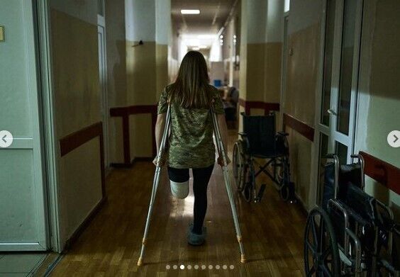 ''Первые два дня плакала, а потом решила бороться'': в сети рассказали о юной защитнице Украины, потерявшей ногу на войне. Фото