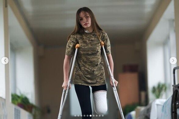 "Перші два дні плакала, а потім вирішила боротися": у мережі розповіли про юну захисницю України, яка втратила ногу на війні. Фото 