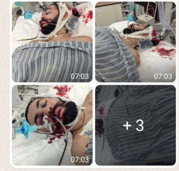 Террориста, устроившего циничное выступление с ''черепом защитника Мариуполя'', догнала ''карма'': ему прострелили голову. Фото