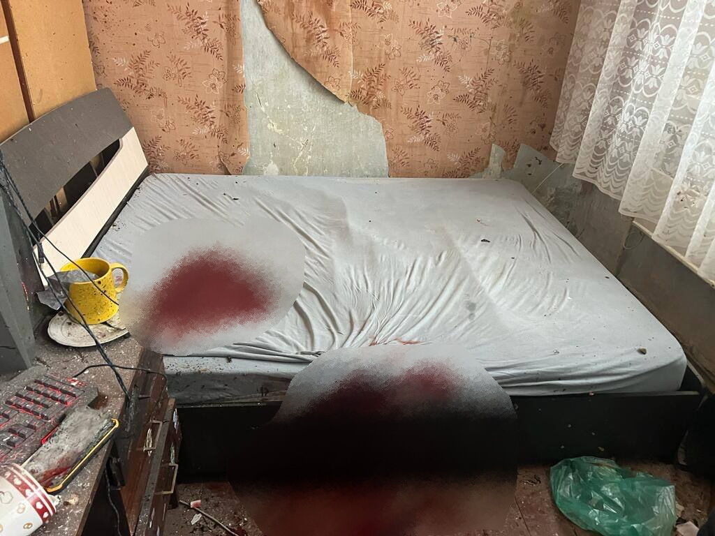 В Киевской области у 21-летнего парня в руках взорвалась граната. Фото и видео
