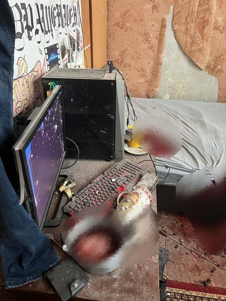 На Київщині у 21-річного хлопця в руках вибухнула граната. Фото та відео