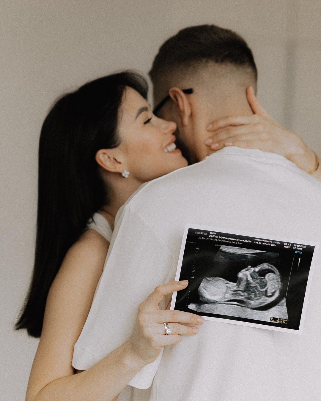 Украинская блогер-миллионница объявила, что впервые станет мамой. Фото