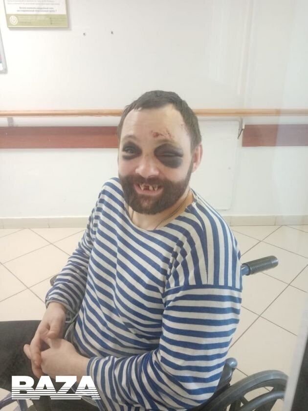 Российский оккупант Алексей Лымарь в больнице