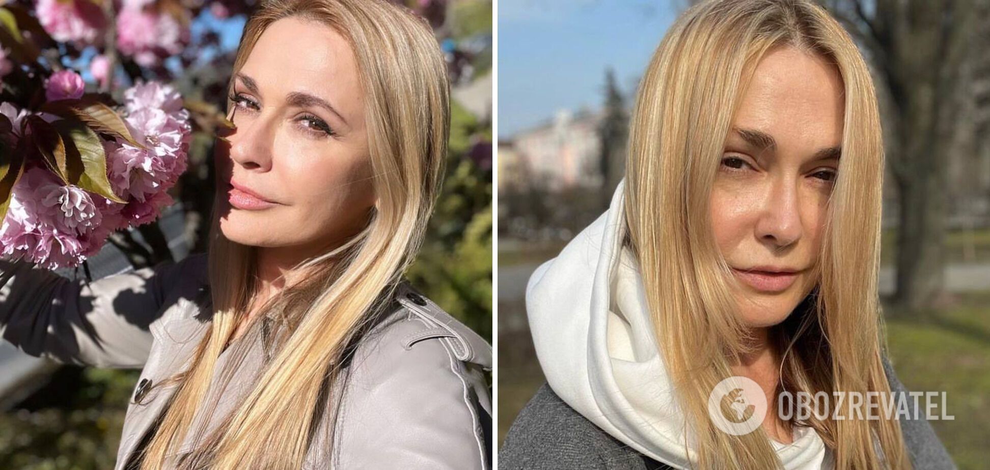 Седые волосы, нервные срывы и бессонница: как украинские звезды изменились за год войны. Фото