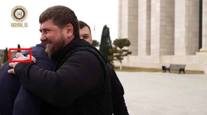 Кадыров после слухов о болезни впервые появился на людях: на руке заметили медицинский прибор. Фото