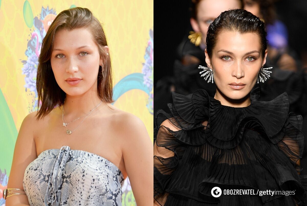 Меган Фокс изменила форму носа, а Джоли – грудей и скул: 5 звезд, которые сделали пластику до 30 лет. Фото до и после