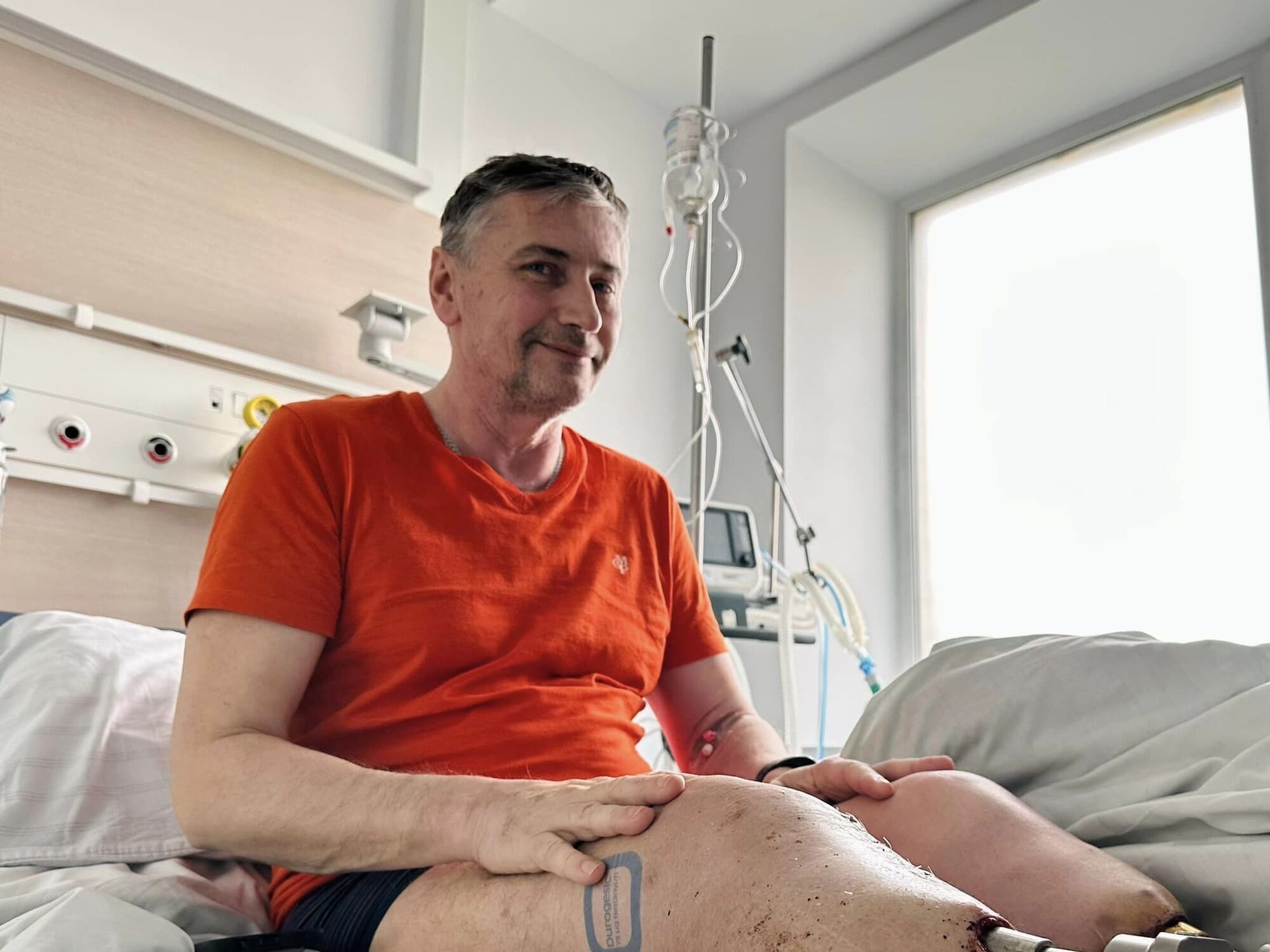 В Україні вперше імплантували протез в кістку пацієнта: лікарі обіцяють, що військовий зможе ходити вже за пів року. Фото 