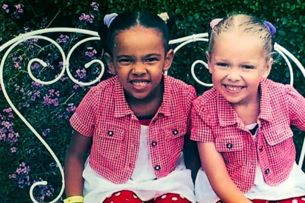 "Один випадок на мільйон": як склалася доля близнючок із різним кольором шкіри, фото яких облетіли світ