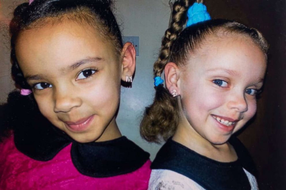 "Один случай на миллион": как сложилась судьба близняшек с разным цветом кожи, фото которых облетели мир