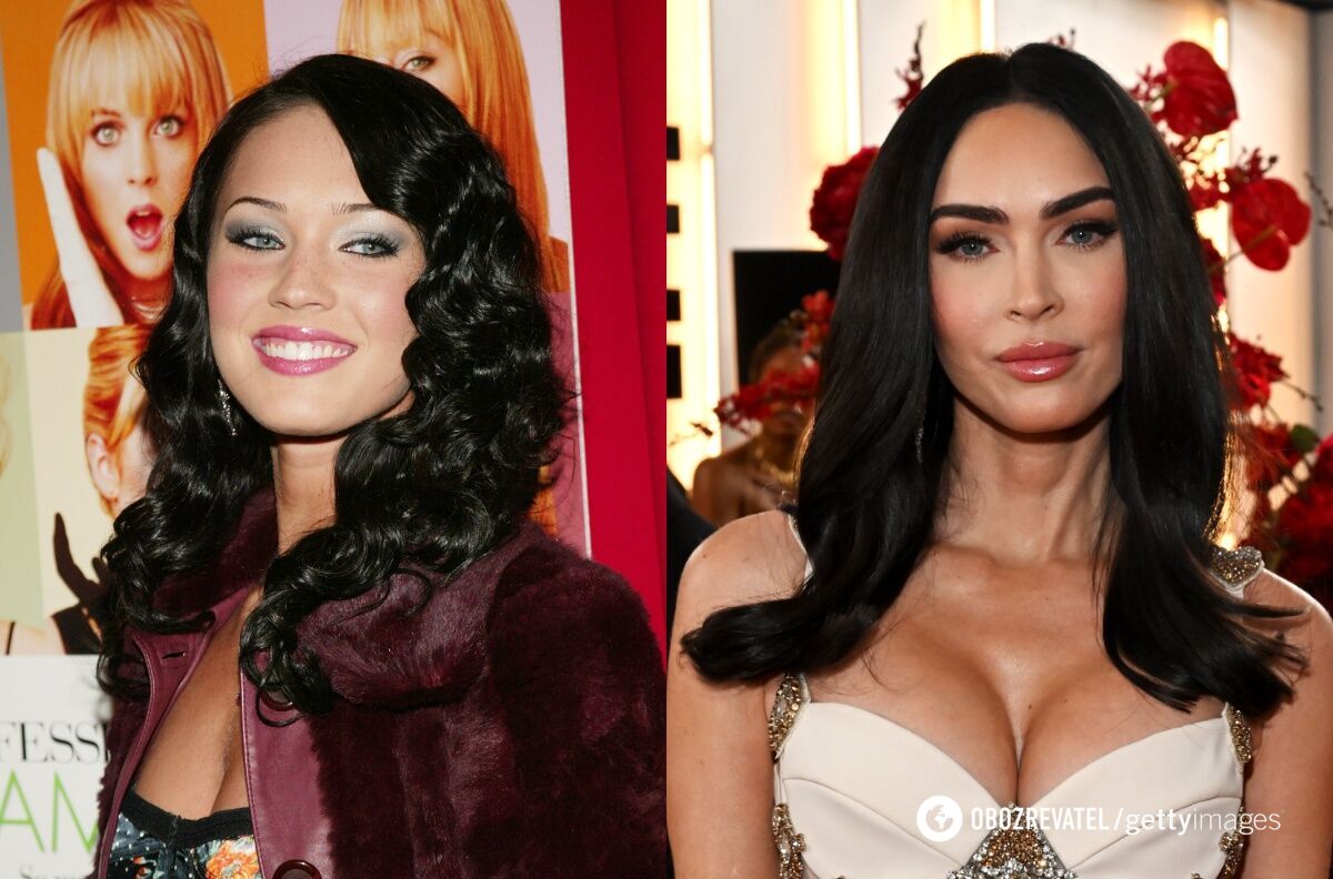 Позбулися пухких щік: 5 знаменитостей, які видалили грудки Біша. Фото до і після