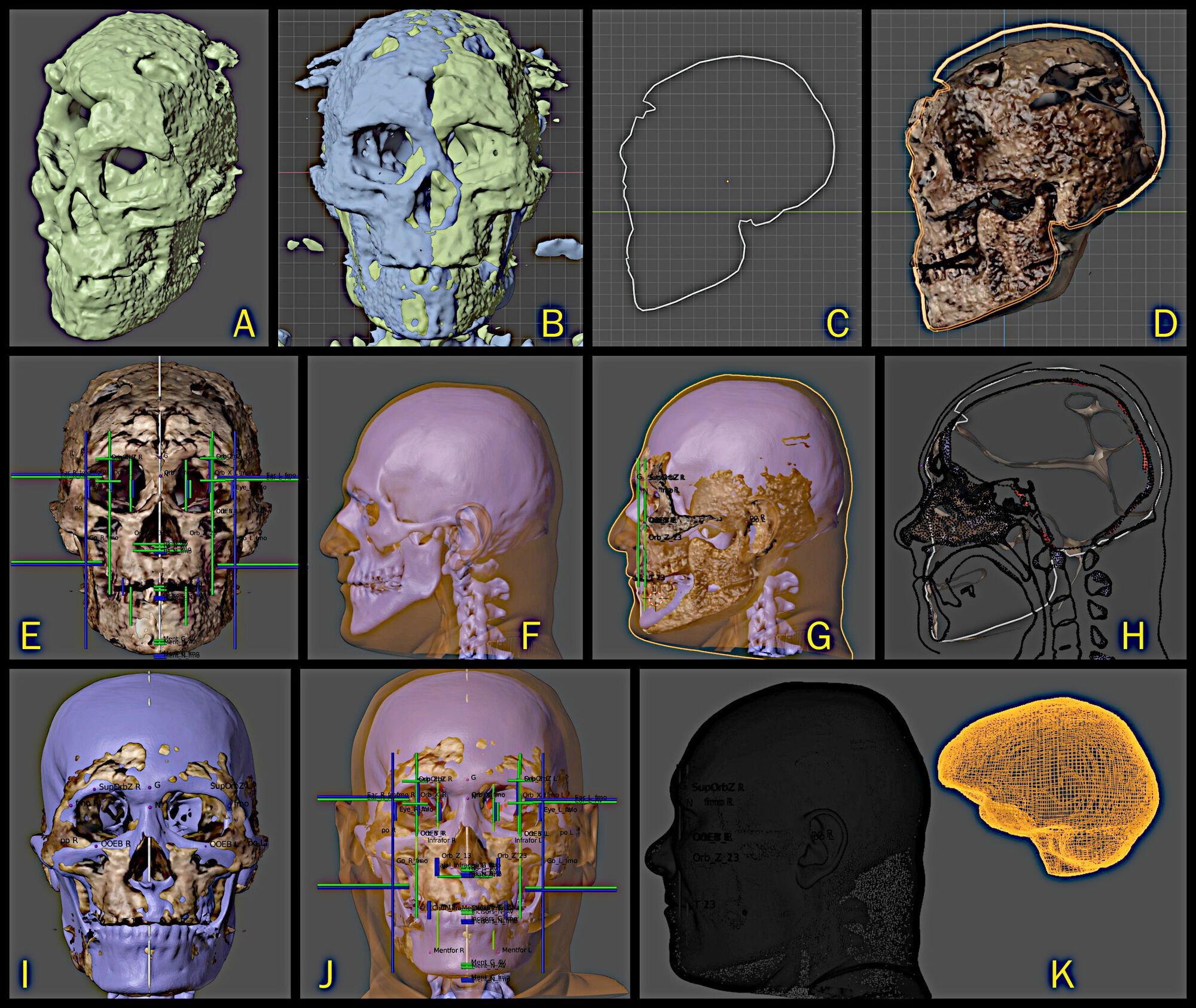 Процесс цифровой реконструкции черепа Homo sapiens