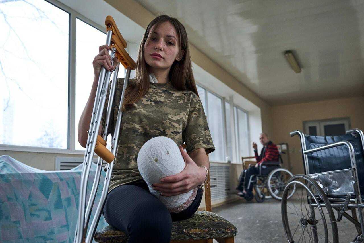 "Стала символом незламності": у мережі розповіли про юну захисницю України, яка втратила ногу на війні, але не здалася