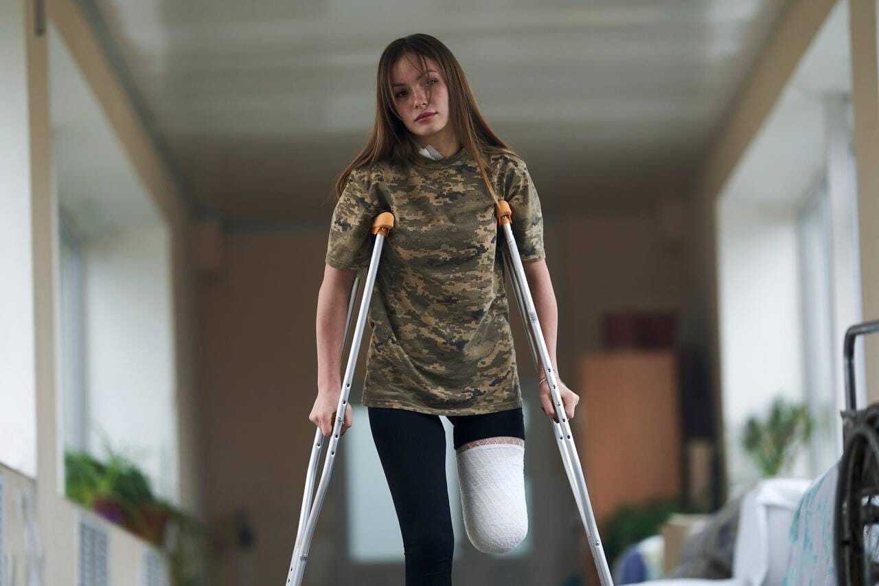 "Стала символом незламності": у мережі розповіли про юну захисницю України, яка втратила ногу на війні, але не здалася