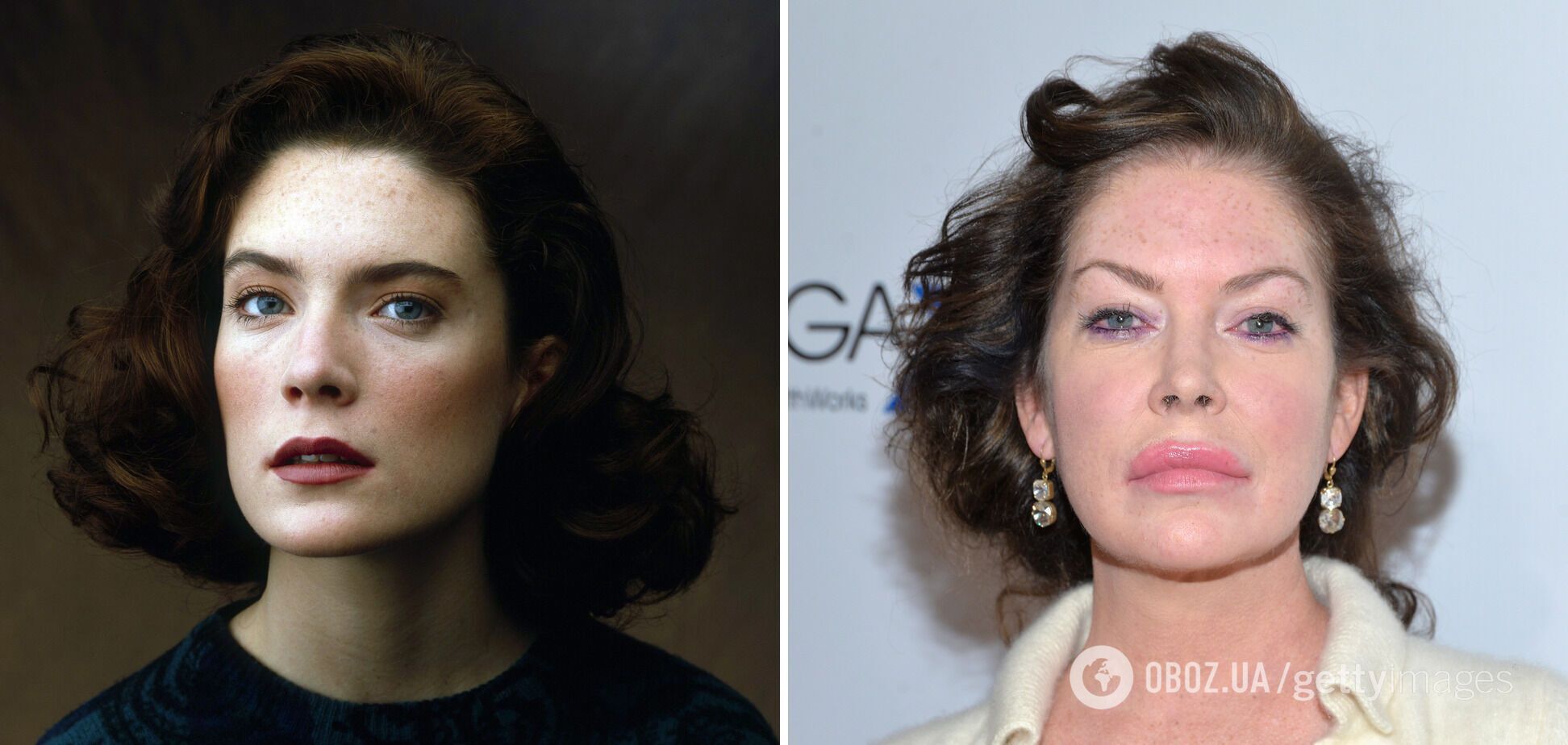 Все пошло не так! Шесть звезд, карьеру которых разрушила неудачная пластика. Фото до и после