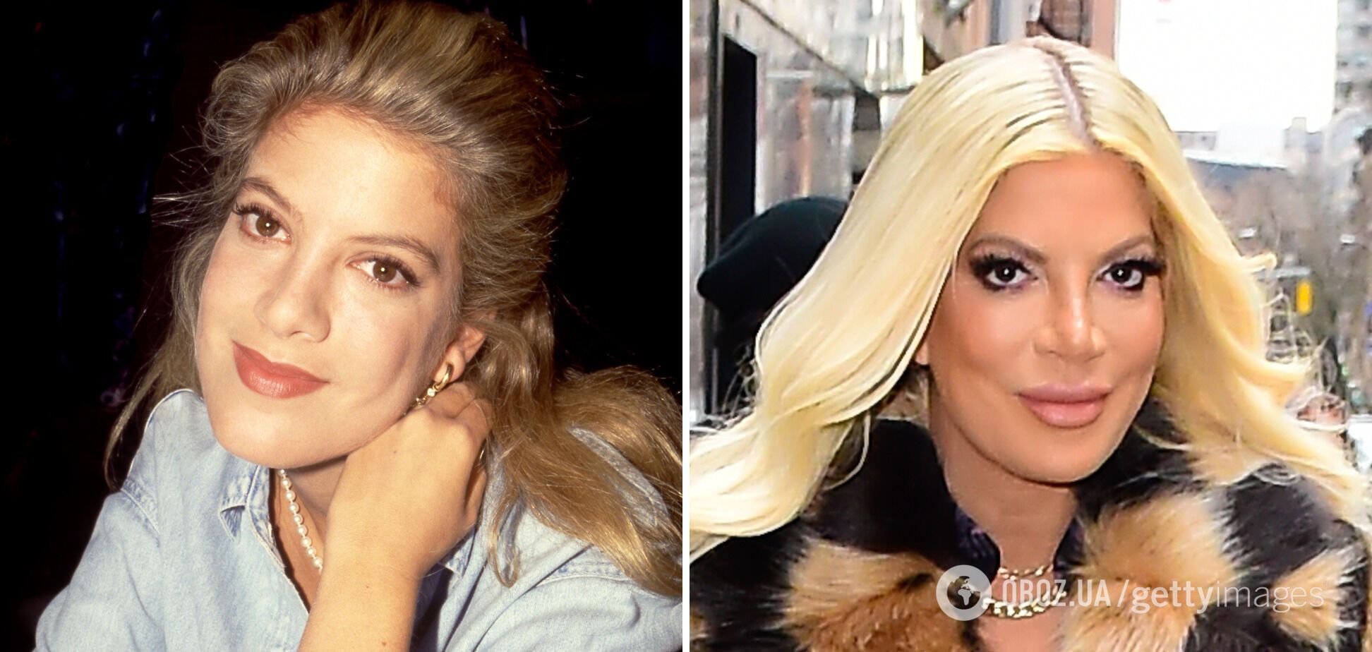 Все пошло не так! Шесть звезд, карьеру которых разрушила неудачная пластика. Фото до и после