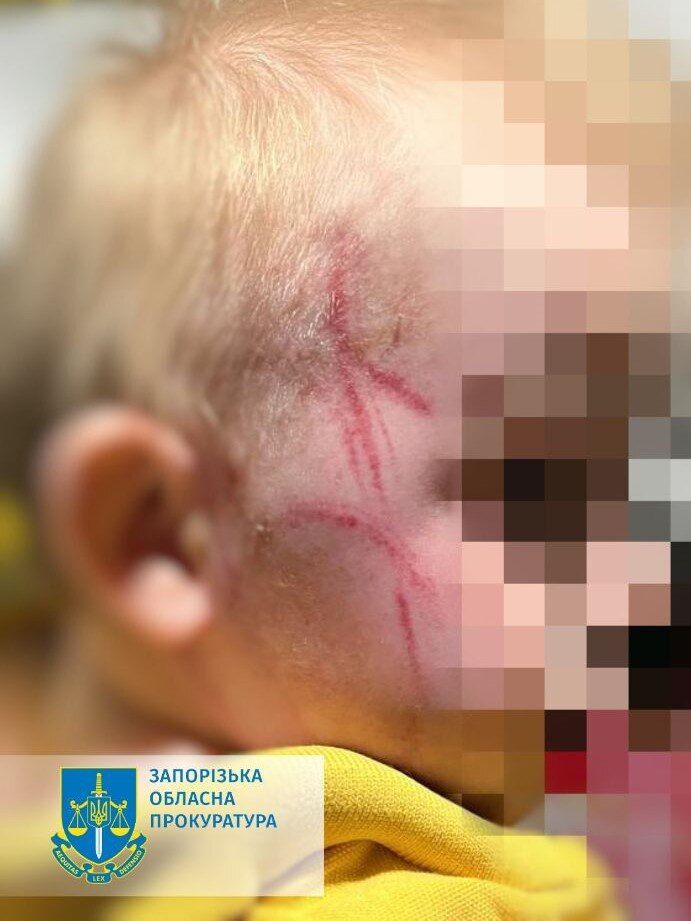 На Запоріжжі п'яна мати побила однорічного сина за капризи під час купання