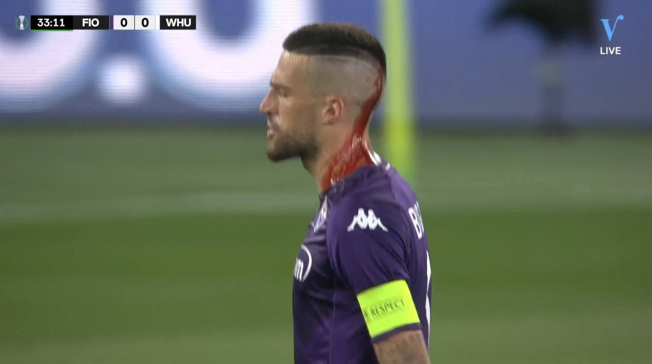 На финале Лиги конференций брошенный стакан разбил в кровь голову футболисту. Матч был остановлен. Видео