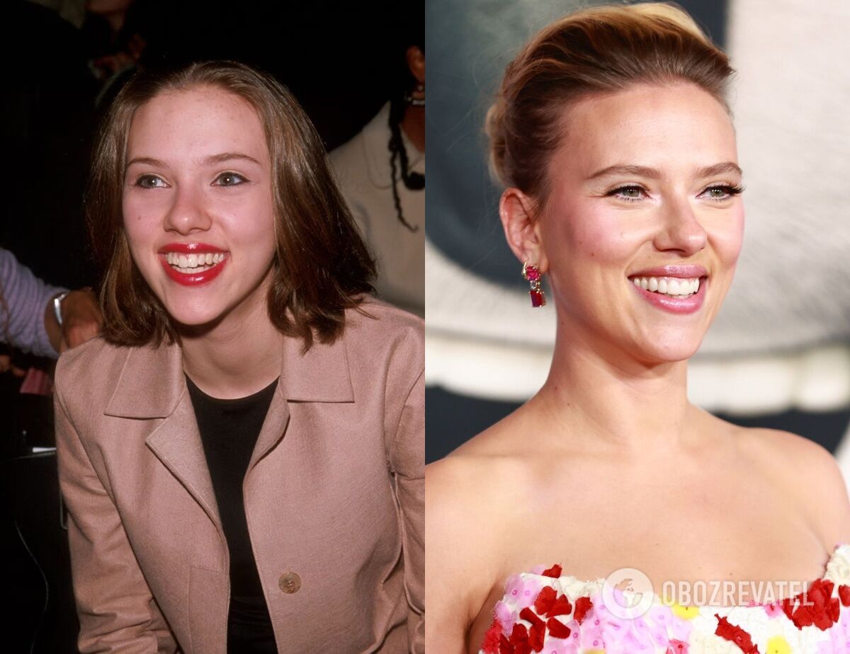 Приховали дефекти усмішки: 5 зіркових красунь, які поставили штучні зуби. Фото до і після реставрації