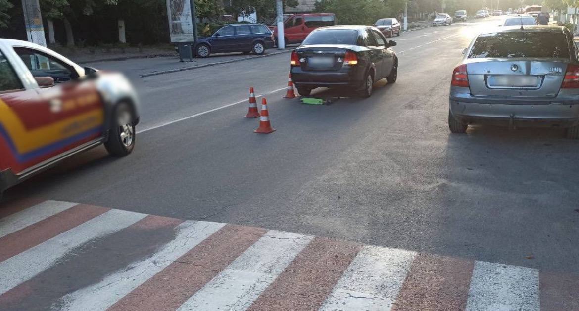 Под Киевом женщина на пешеходном переходе сбила ребенка на самокате. Фото