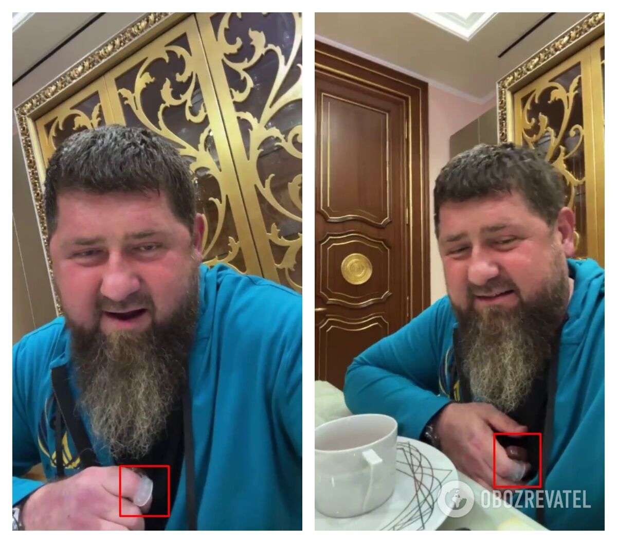 Кадыров засветил на пальце странный аппарат, который он называет электронными четками .