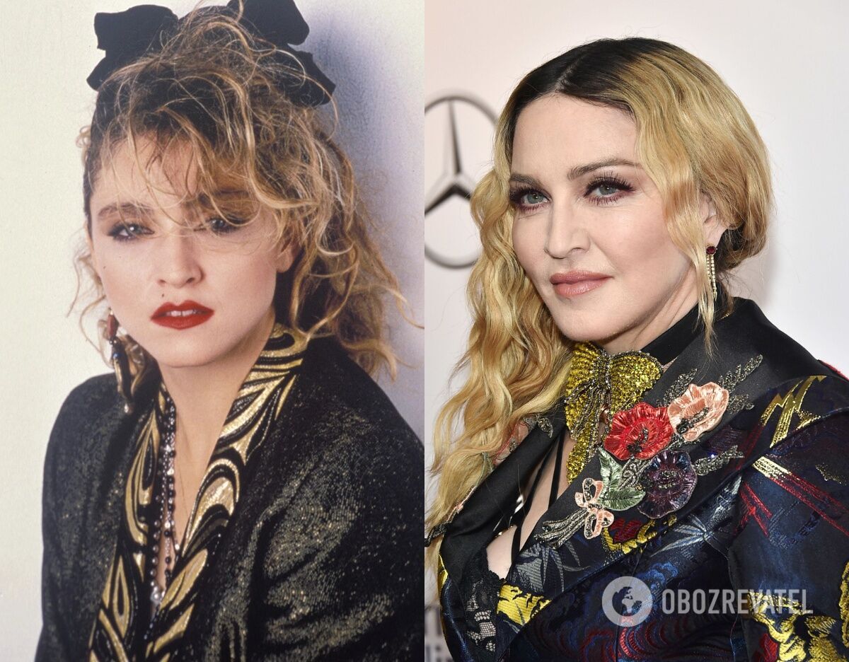 Демі Мур, Мадонна та інші зірки, які змінили форму підборіддя. Фото до та після