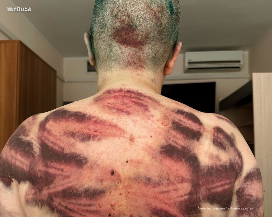 Жорстоко побили і побрили налисо: з’явилися фото журналістки, на яку напали у Чечні