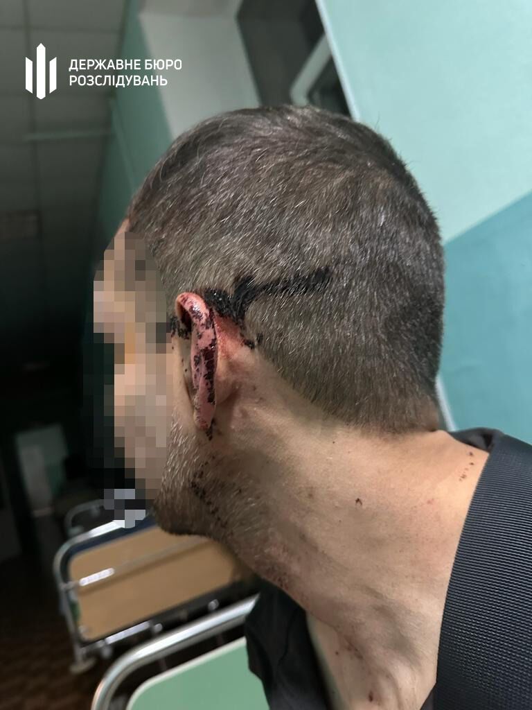 На Одещині у військовій частині побили бійця, чоловік потрапив до лікарні: справою зайнялося ДБР. Фото 