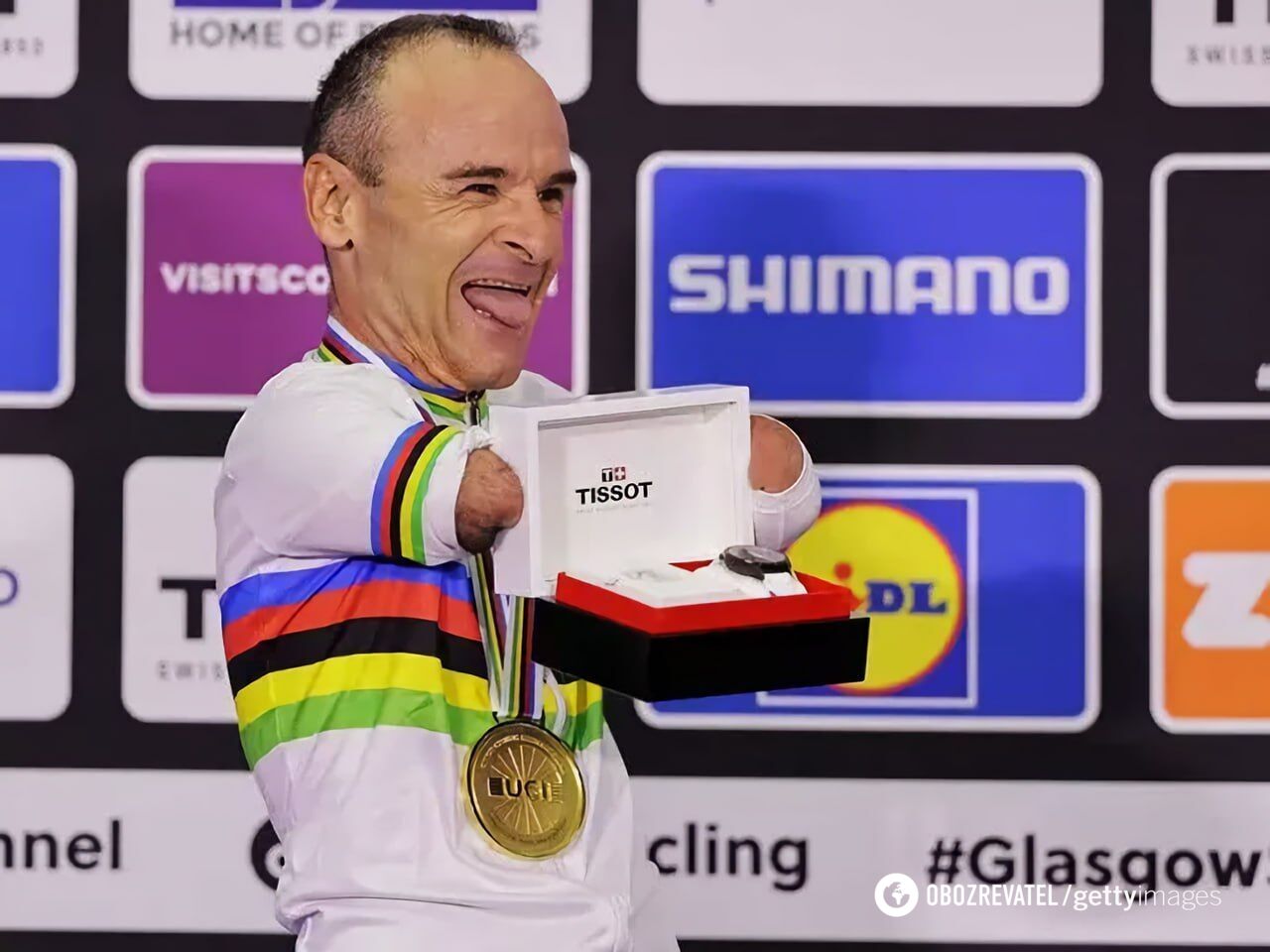 Безрукий велосипедист выиграл чемпионат мира. Его наградили наручными часами. Видео