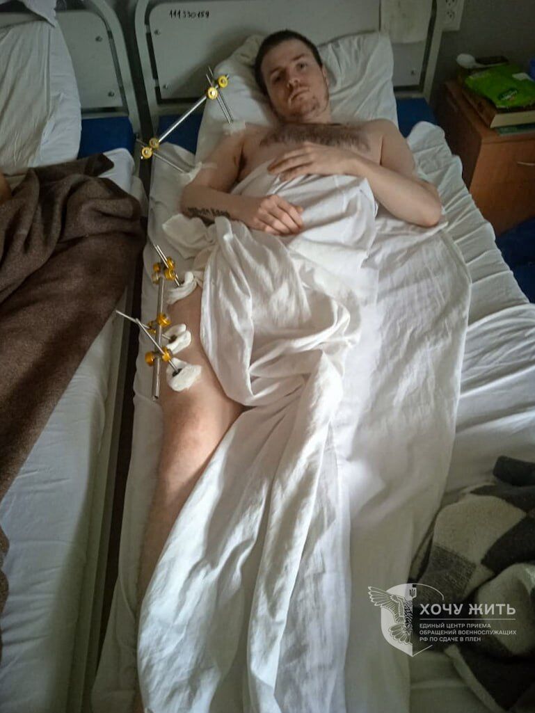 Росія не забирає своїх поранених полонених: проєкт "Хочу жити" оприлюднив списки. Фото