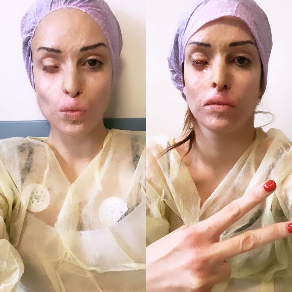 Нотаро в больнице