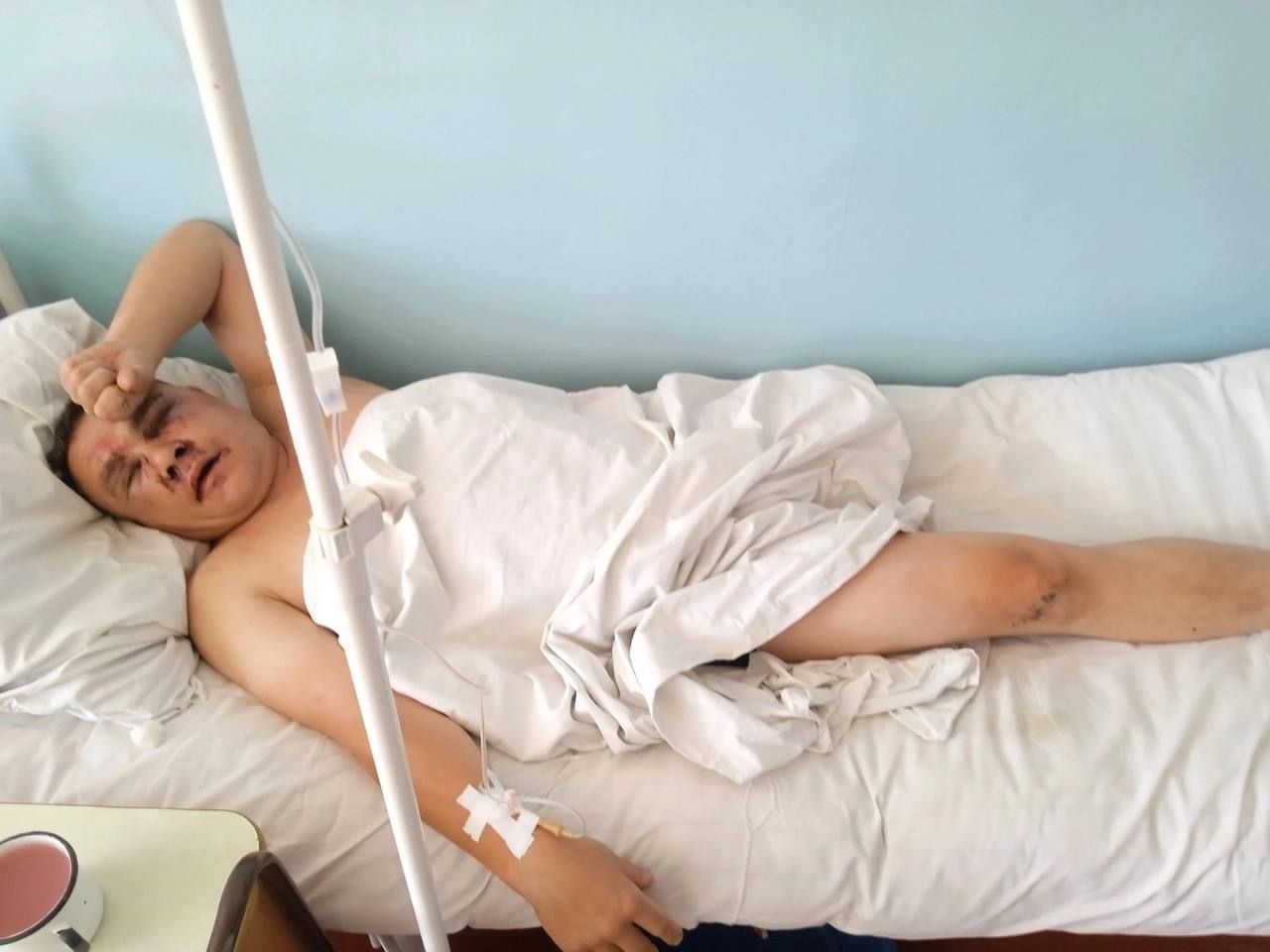 Бумеранг повернувся? На Забайкаллі жорстоко побили окупанта, який втратив ногу на війні проти України. Фото 