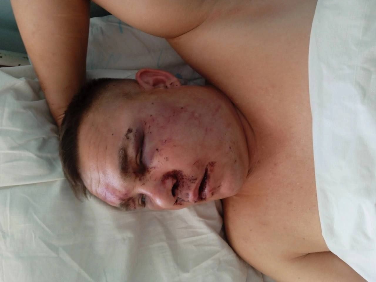 Бумеранг повернувся? На Забайкаллі жорстоко побили окупанта, який втратив ногу на війні проти України. Фото 