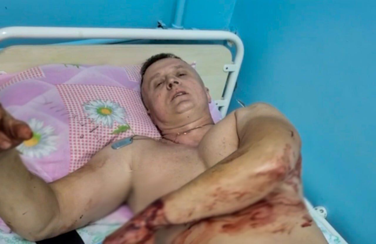 Отримав поранення, коли допомагав іншим: під час удару РФ по Покровську постраждав герой фільму "20 днів у Маріуполі". Фото 