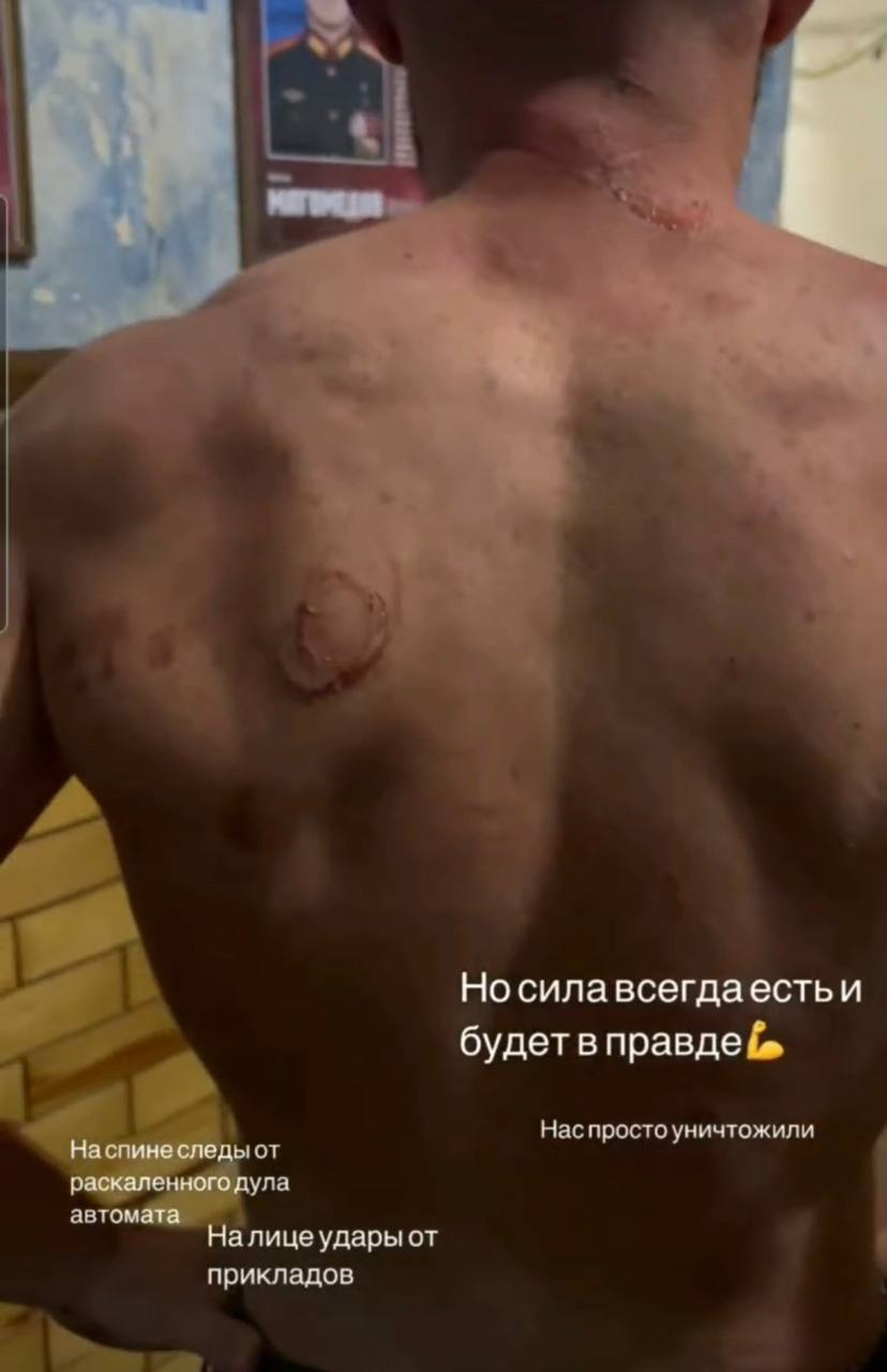 "Я думал, нацисты по ту сторону": "мобик" из Северной Осетии пожаловался на издевательства солдат из армии Путина. Видео