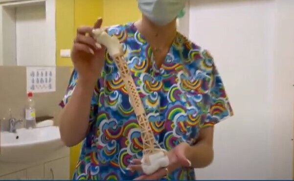 Во Львове больному онкологией мальчику установили напечатанную на 3D-принтере кость, которая будет расти вместе с ним. Видео