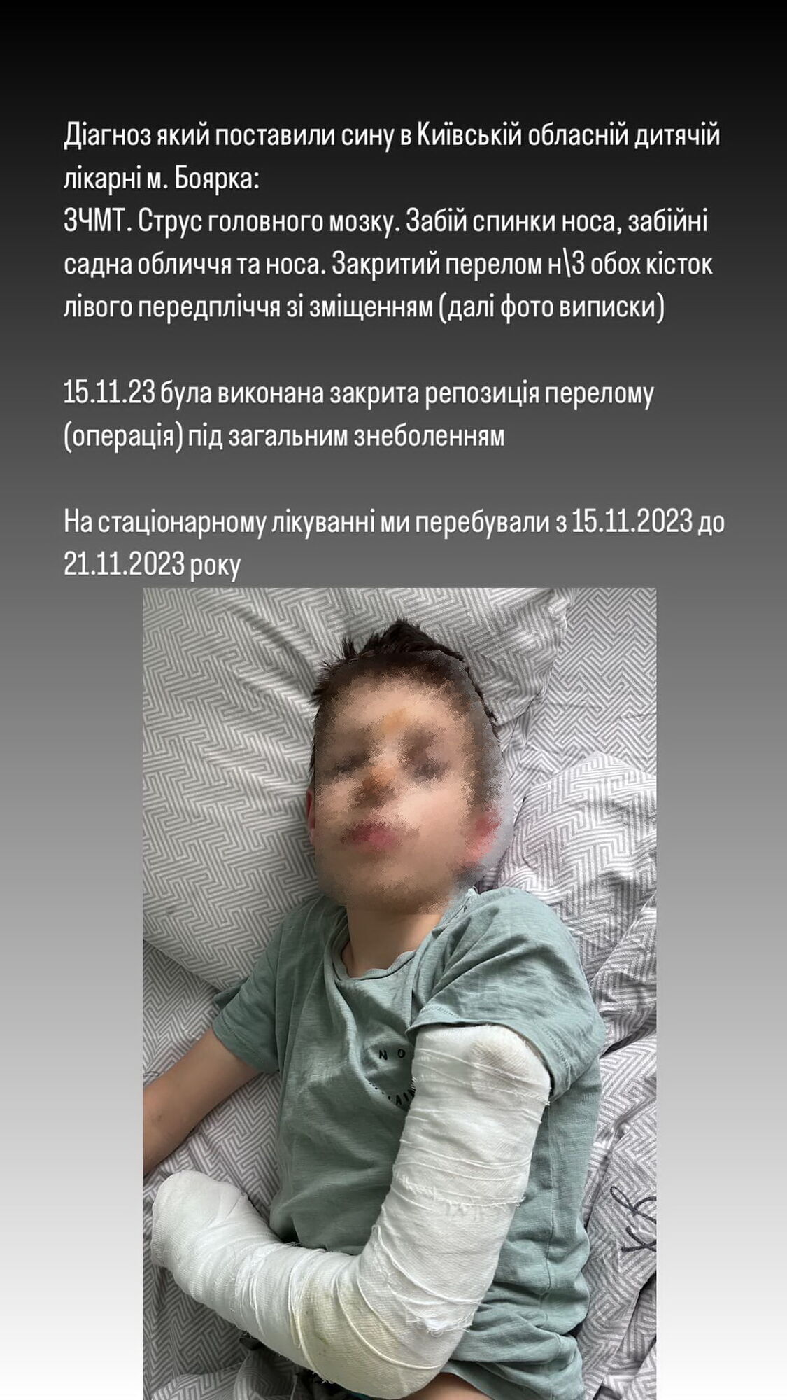 Закрытый перелом и сотрясение мозга: на Киевщине в гимназии ребенка толкнули с высоты. Подробности инцидента и видео