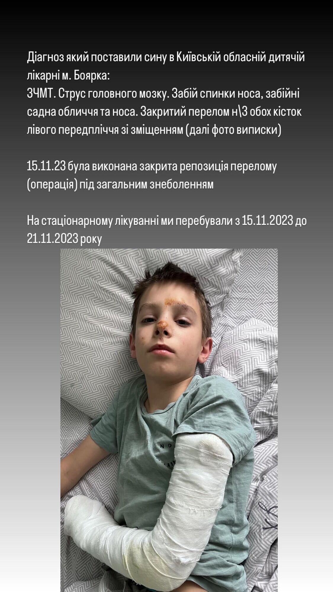 В гимназии Василькова под Киевом мальчик столкнул одноклассника с высоты: ребенок получил травму головы и перелом руки