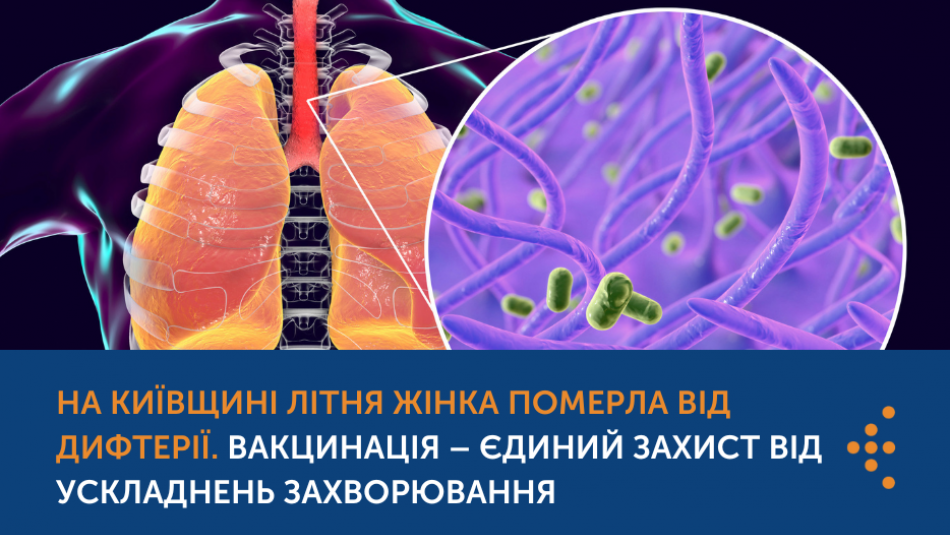 Тривалий час займалась самолікуванням: на Київщині від дифтерії померла 73-річна жінка