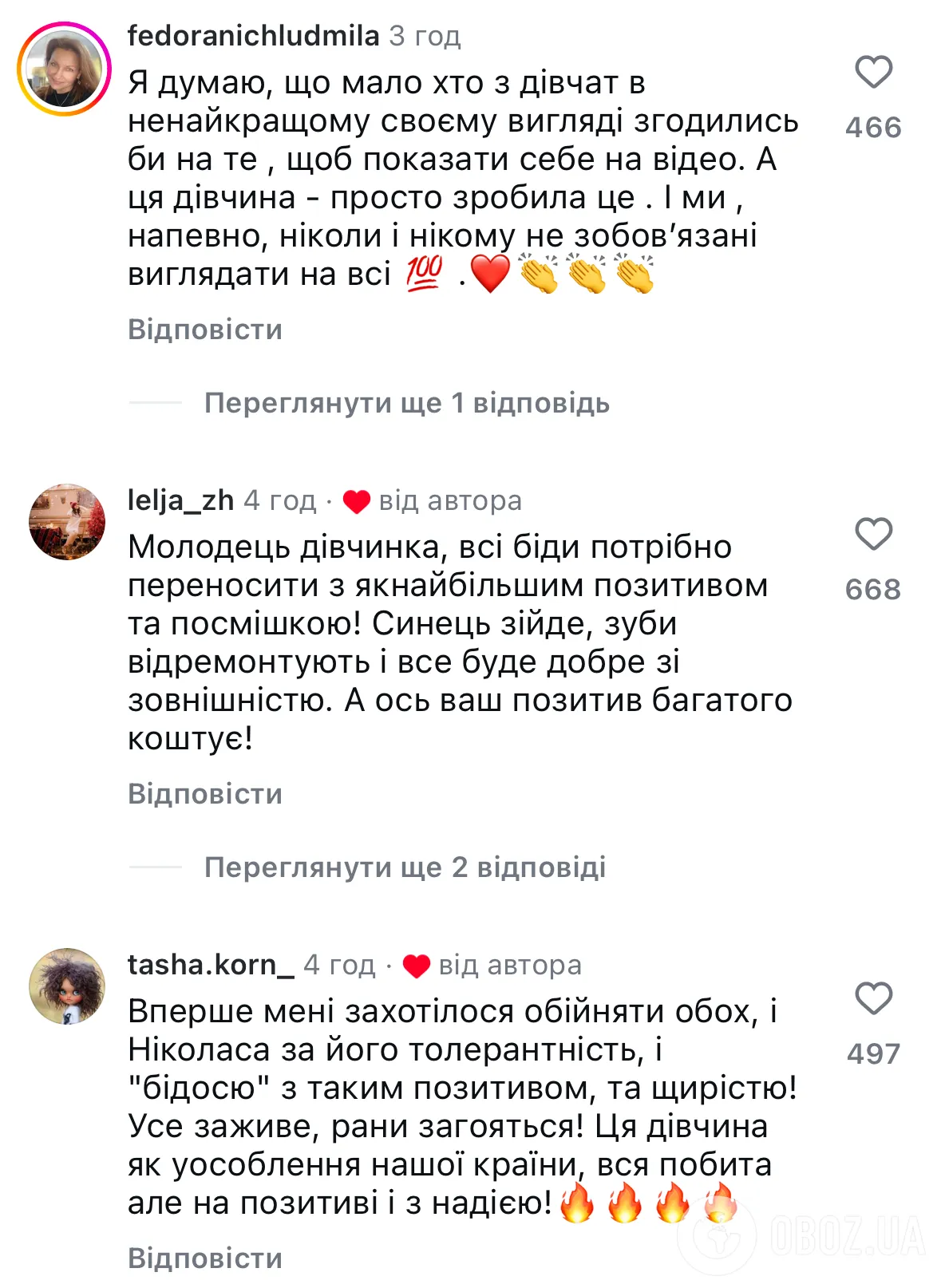 Жительница Запорожья, которая упала со второго этажа и выбила зубы, стала звездой сети: украинцы в восторге от ее оптимизма. Видео