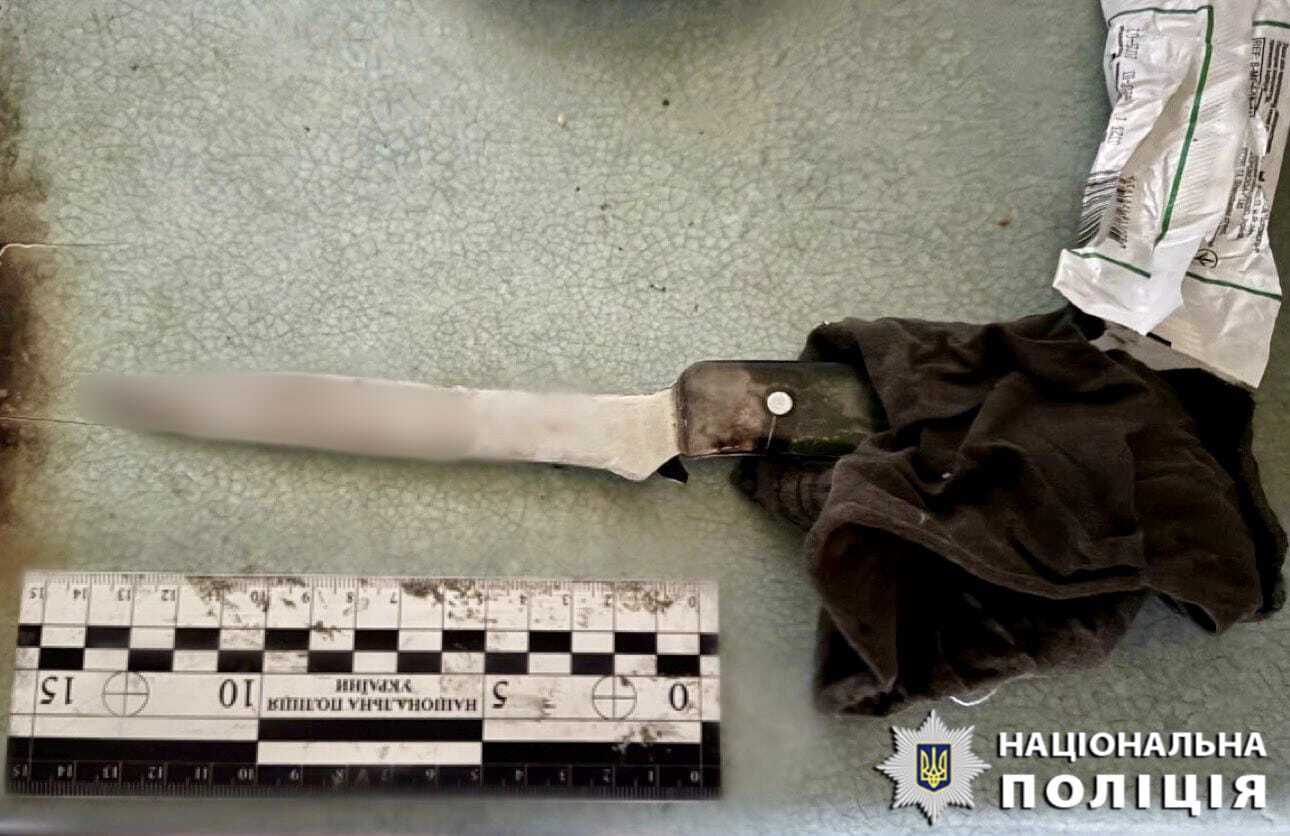 В Киевской области теща во время ссоры чуть не убила зятя ударом ножа в грудь. Фото