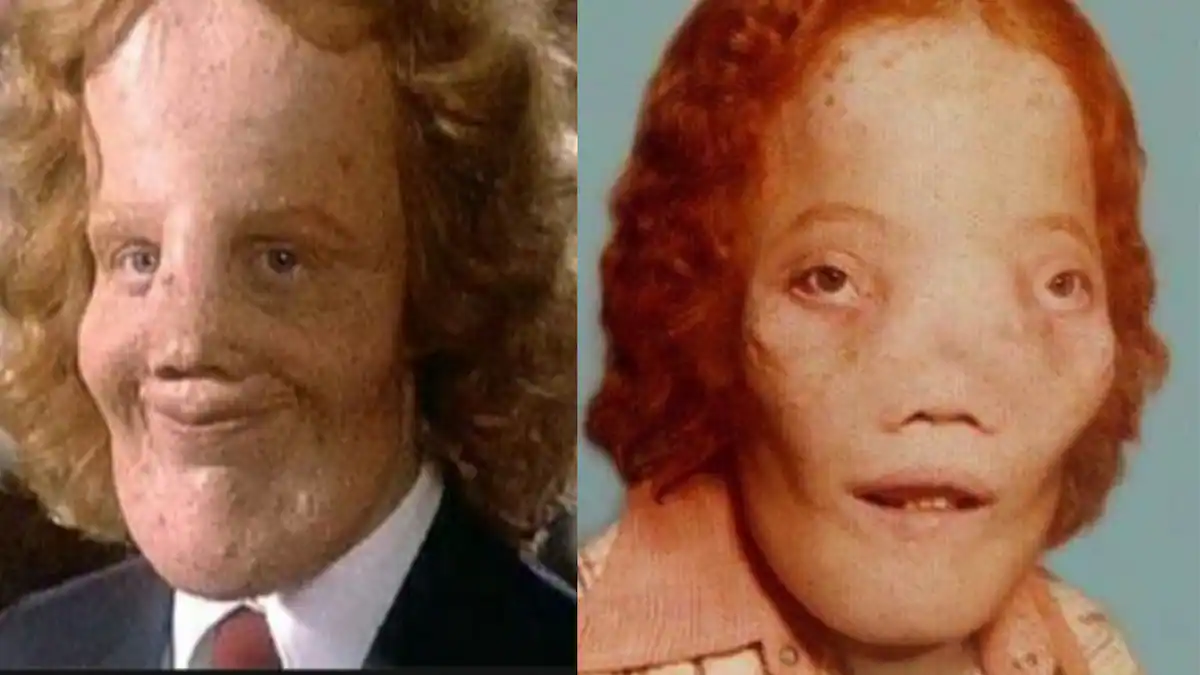 Обличчя збільшилося вдвічі: яка реальна історія лягла в основу фільму "Маска" 1985 року, де зіграла співачка Шер