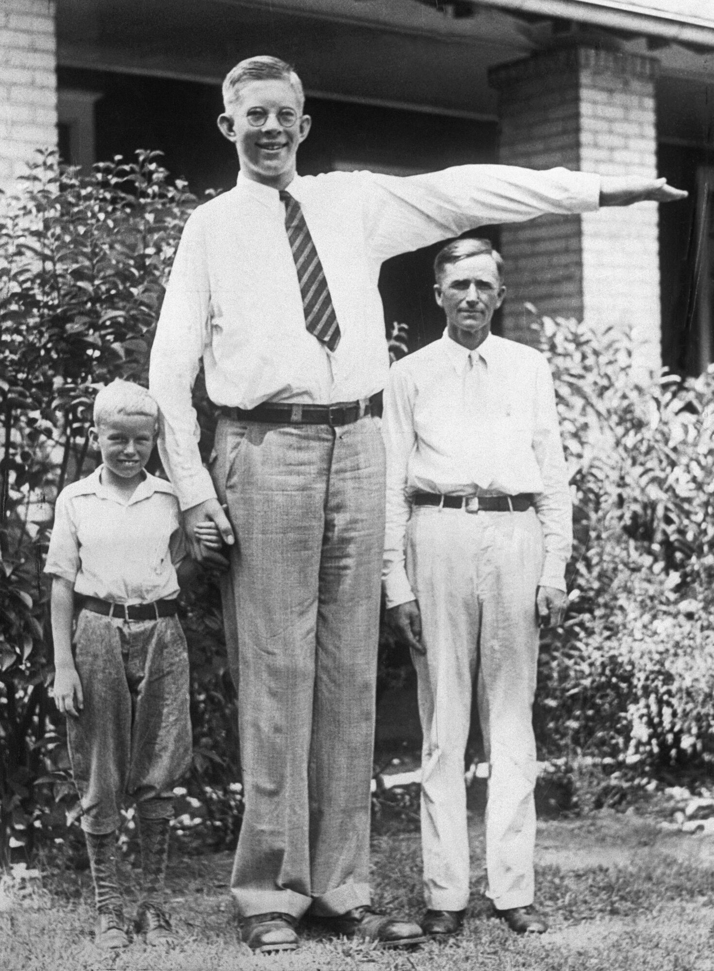 Який вигляд мала найвища людина у світі зі зростом 272 см і чому Роберт Вадлоу так мало прожив. Фото і відео 